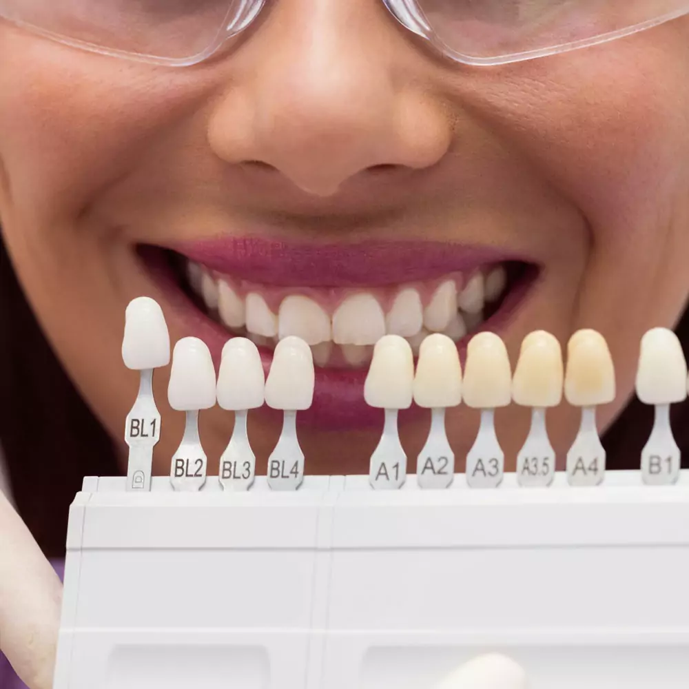 Home 8 Porcelain shade guide used to match a natural tooth color